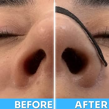 Nasal Strips Stop Snoring